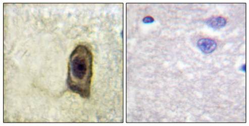 CSFR (Phospho-Tyr561) Antibody