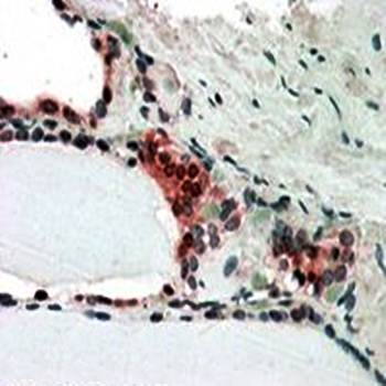 CSN2/TRIP15 Antibody