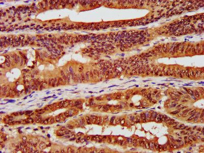 CSNK2A1 Antibody