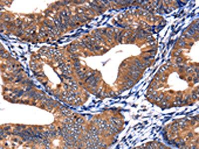 CSNK2A1 Antibody