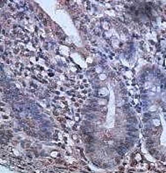 CSNK2A2 Rabbit Polyclonal Antibody