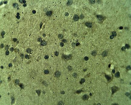 Rabbit Human Cysteine string protein (CSP) Alpha, DNAJC5 alpha Antibody