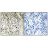 CST1 Antibody
