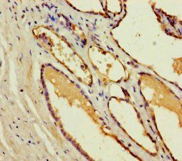 CST11 Antibody