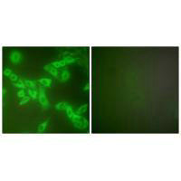 CSTB Antibody