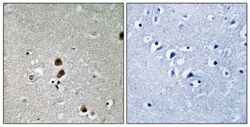 CtBP1 (Phospho-Ser422) Antibody