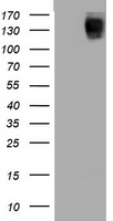 CTBS Antibody
