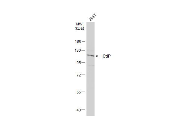 MTGR1 Rabbit Polyclonal Antibody