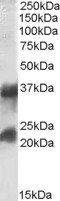 CTLA + CTLB Antibody