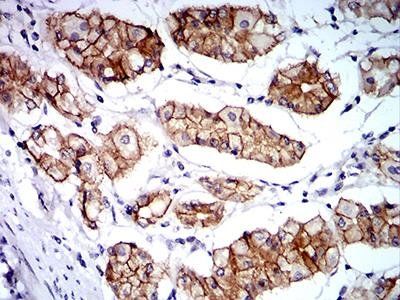 CTNNA1 Antibody
