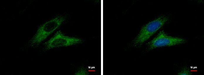 CTNNAL1 Rabbit Polyclonal Antibody