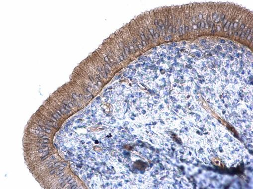 CTNNAL1 Rabbit Polyclonal Antibody