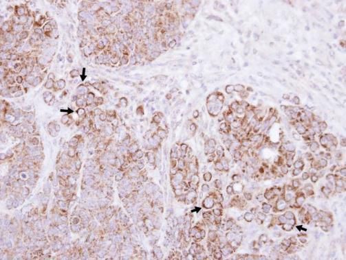 CTNNAL1 Rabbit Polyclonal Antibody