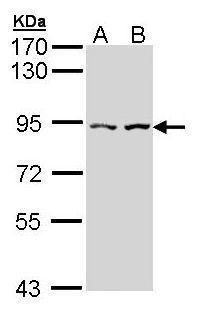 CTNNAL1 Rabbit Polyclonal Antibody