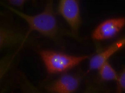 CTNNB1 Antibody