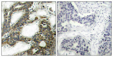 CTNNB1 Antibody