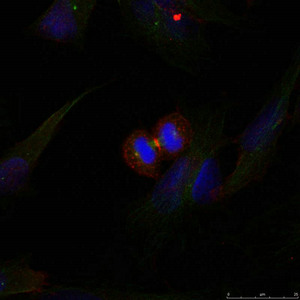 CTNNB1 Antibody