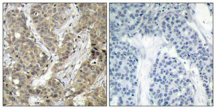CTNNB1 Antibody