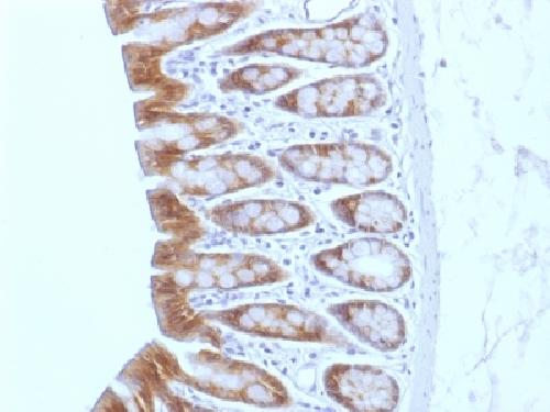 CTNNB1 Antibody
