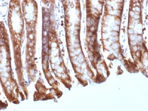 CTNNB1 Antibody