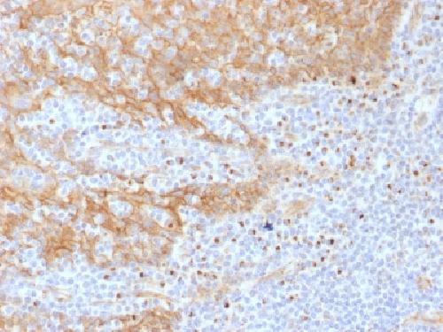 CTNNB1 Antibody