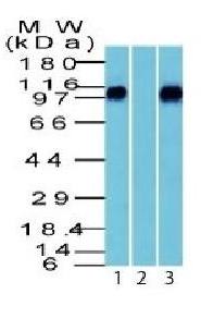 CTNNB1 Antibody