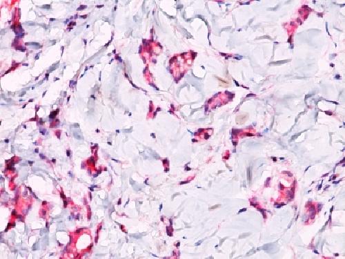 CTNNB1 Antibody