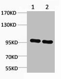 CTNNB1 Antibody