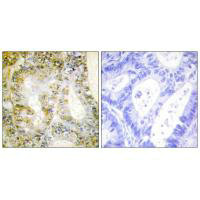 CTNNB1 Antibody