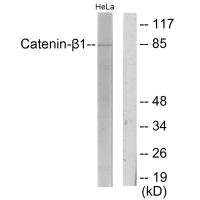 CTNNB1 Antibody