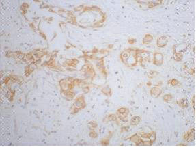 CTNNB1 Antibody