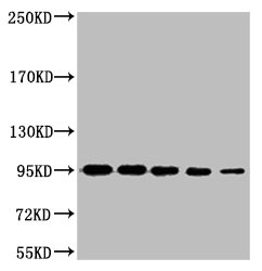 CTNNB1 Antibody