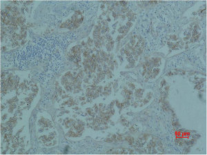 CTNNB1 Antibody