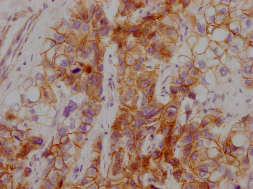 CTNNB1 Antibody