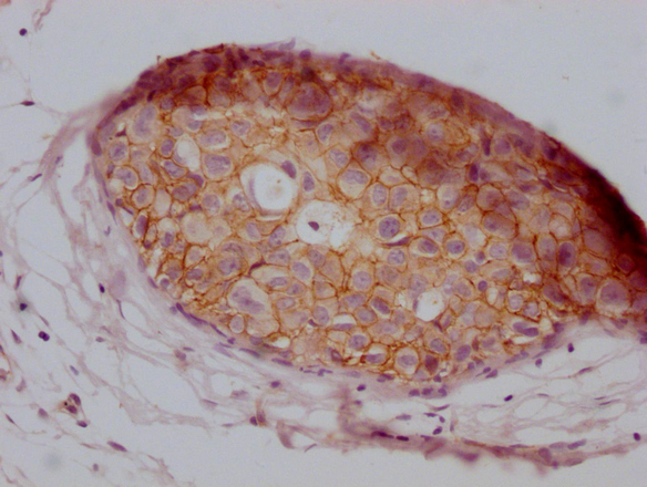 CTNNB1 Antibody