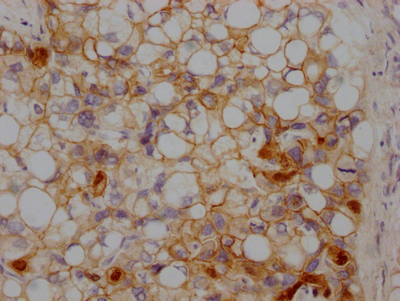 CTNNB1 Antibody