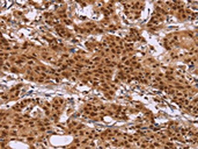 CTNNBL1 Antibody