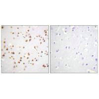 CTNND1 Antibody