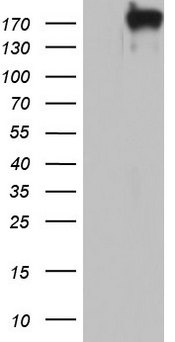 CTNND1 Antibody