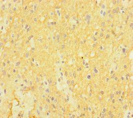 CTNND2 Antibody