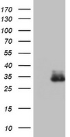 CTP synthase Antibody