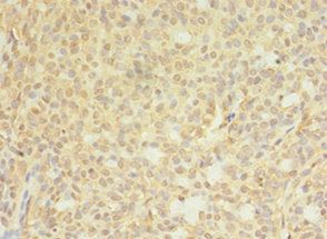 CTPS1 Antibody