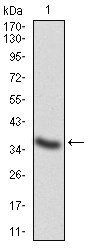 CTSD Antibody