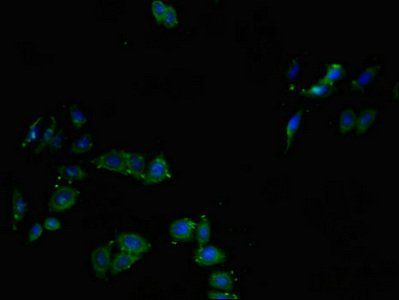 CTSL Antibody