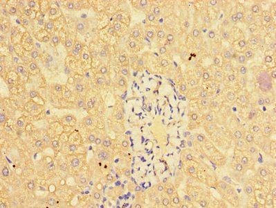 CTSL Antibody