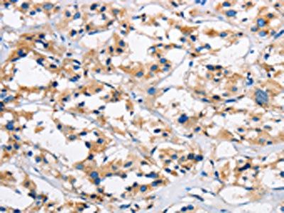 CTSL Antibody