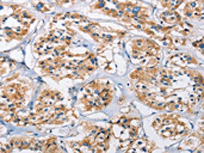 CTSL Antibody