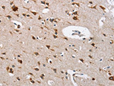 CTSL Antibody