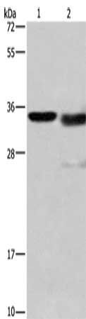 CTSL Antibody