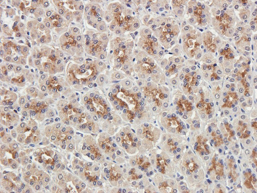 CTSS Rabbit Polyclonal Antibody